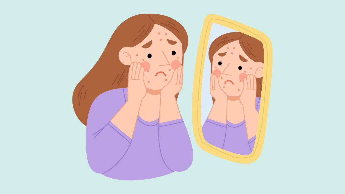 Self security: Feeling self-conscious, teens with acne could be bullied and singled out by others, making them feel alone. It is important for teens to understand that acne is a normal occurrence that everyone faces.